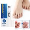 Hot Nail Fungal Pen Anti Fungus Blue Light Laser Pen Onychomycosis Painless Nail Repair Pen Nail Care Repair Serum